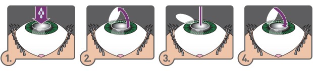 typical lasik eye surgery costs in uk clinics laser eye surgery hub how lasik surgery works