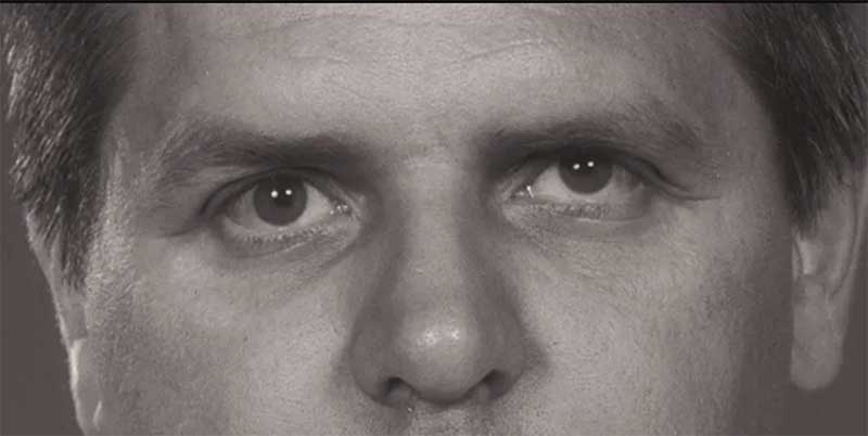 nystagmus example